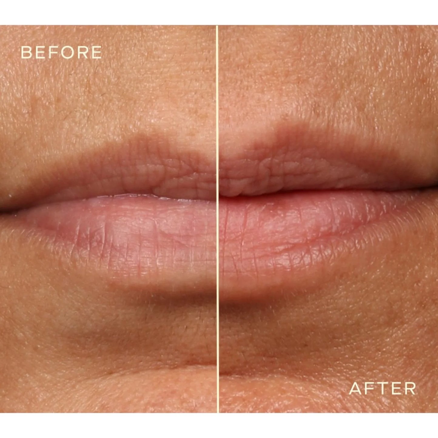 The Lip Plumping and Enhancing Duo