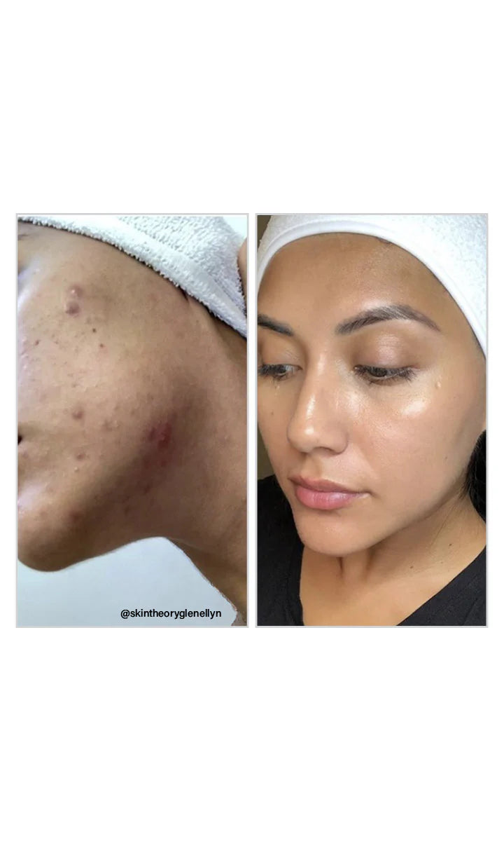 8% Mandelic Acid Serum