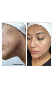 8% Mandelic Acid Serum