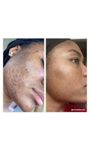 8% Mandelic Acid Serum