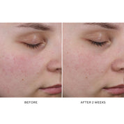 Pore Refining Complex Serum