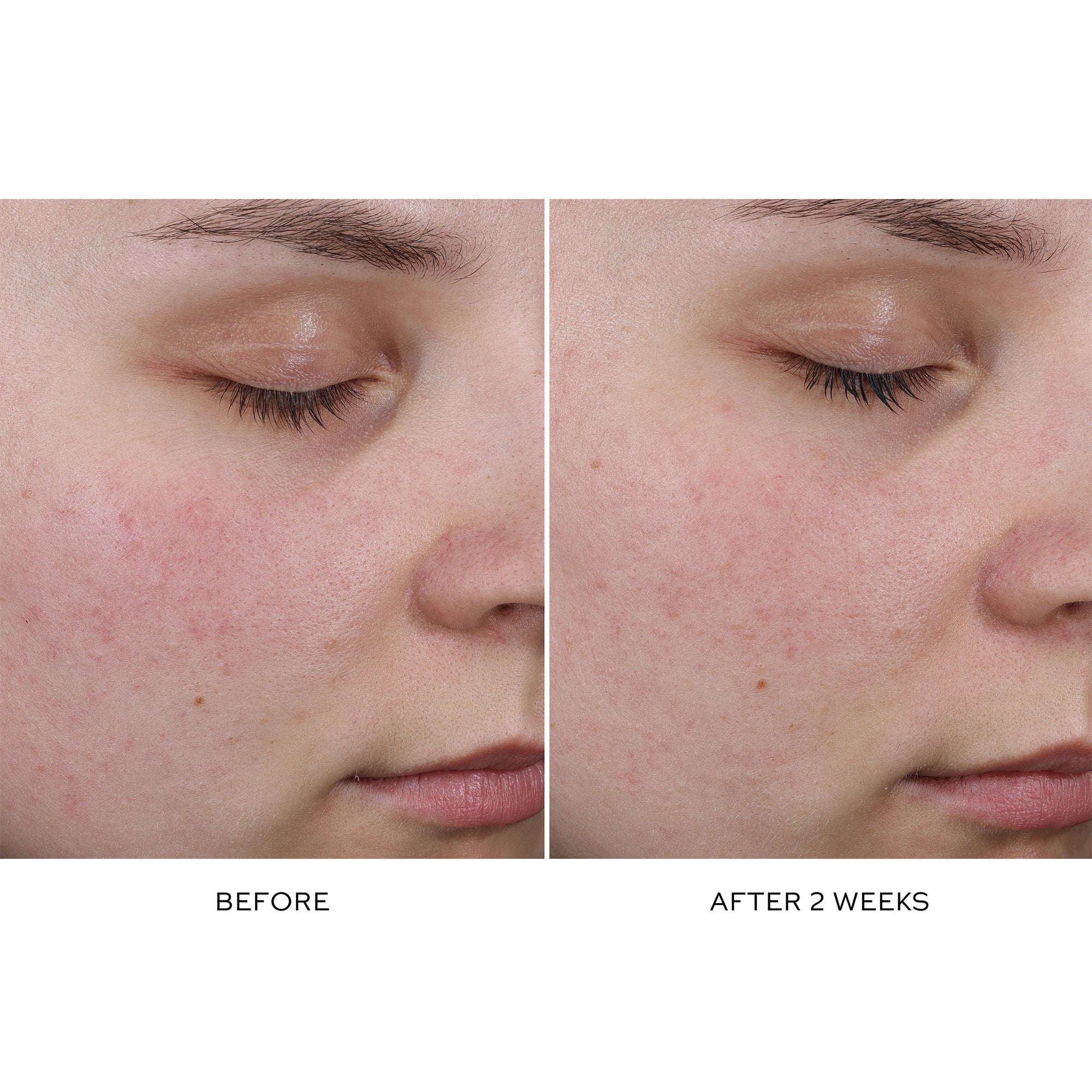 Pore Refining Complex Serum