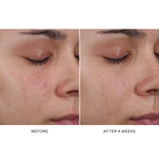 Pore Refining Complex Serum