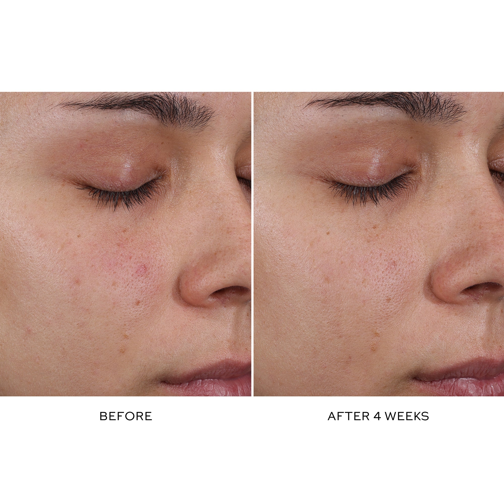Pore Refining Complex Serum