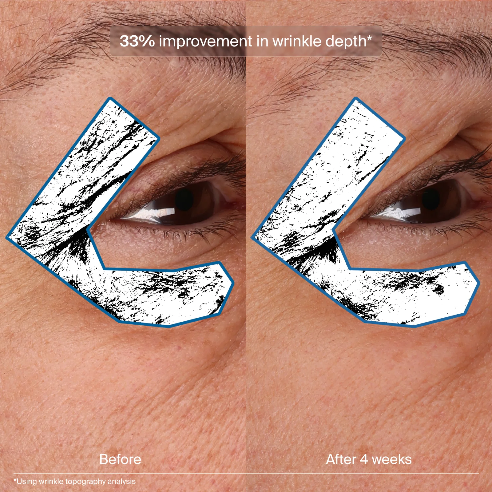 Bioadaptive Stress Repair