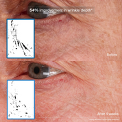 Bioadaptive Stress Repair