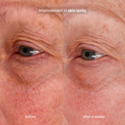 Bioadaptive Stress Repair