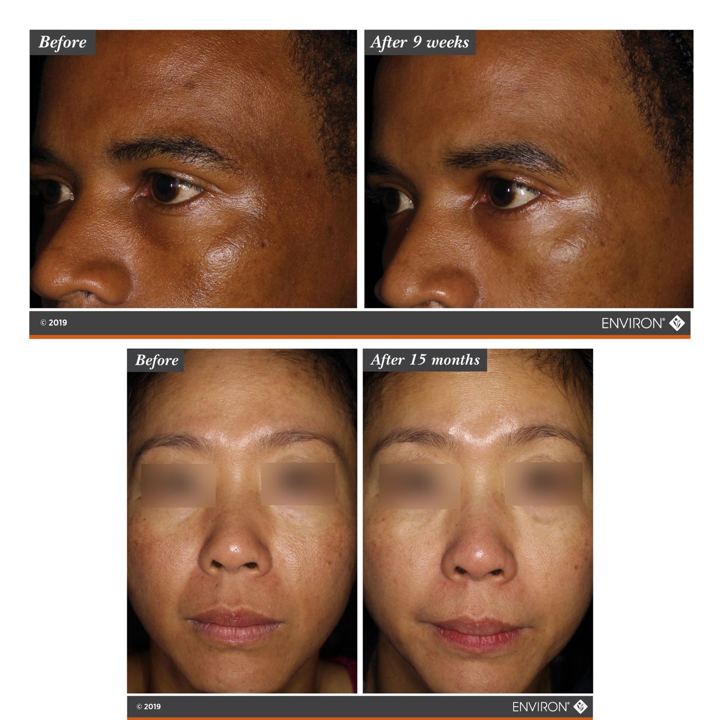 Mela-Fade Serum A+B