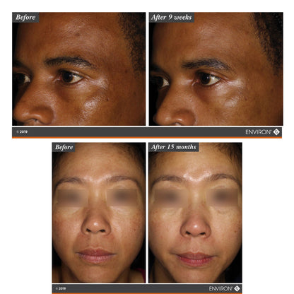 Mela-Fade Serum A+B