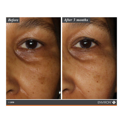 Mela-Fade Serum A+B