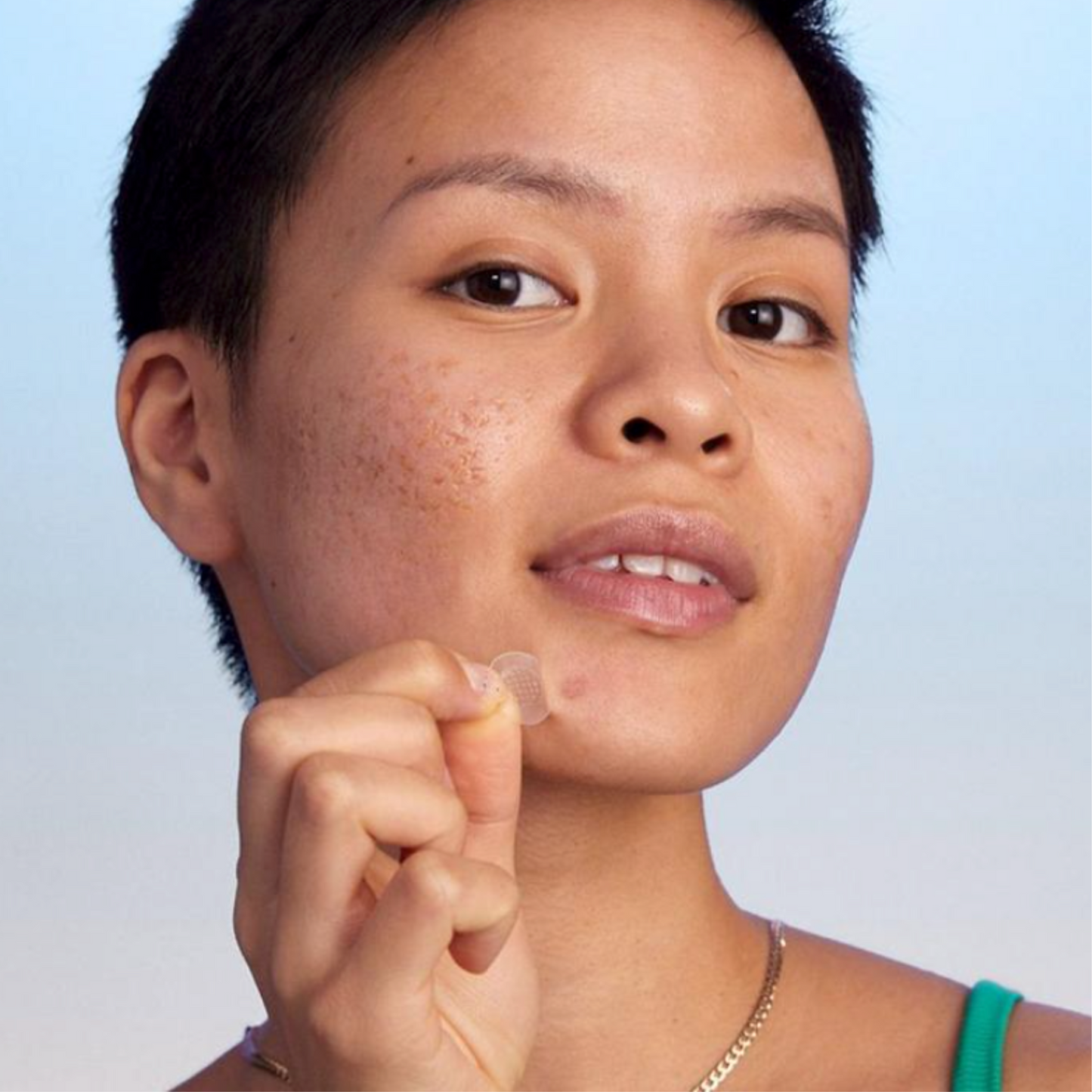 KILLA Kit Microdart Patch: Deep, Early-Stage Zit Treatment