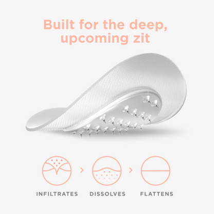 KILLA Kit Microdart Patch: Deep, Early-Stage Zit Treatment